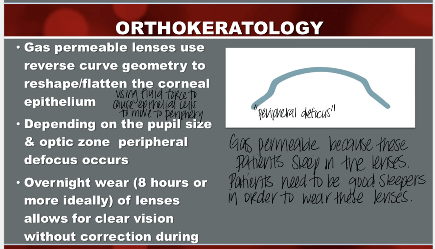 <p>_______ wear of orthokeratology lenses allows for clear vision without day time correction</p>