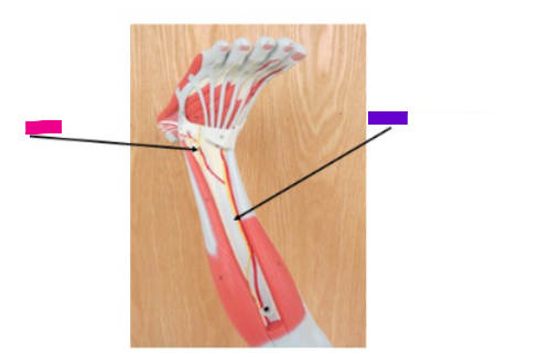 <p>What is the pink arrow?</p>