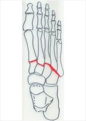 <p>ID joints</p>