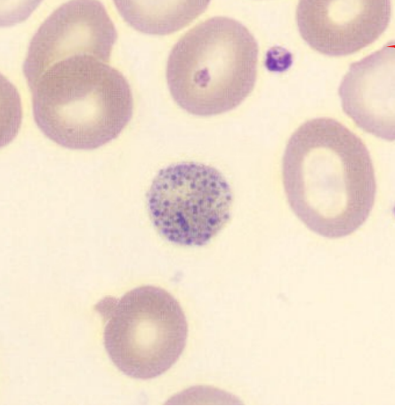 <p>occurs when residual RNA appears as distinct <strong>blue dots</strong> all over the cell’s cytoplasm </p>