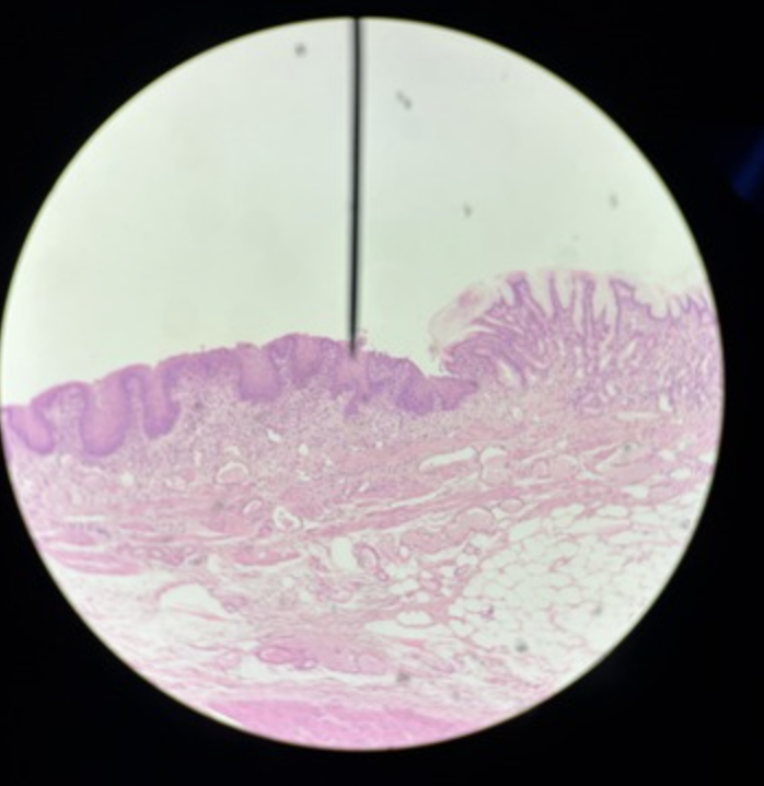 <p>Identify structure &amp; which side</p>