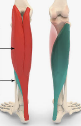 <p>Which muscle is in red?</p>
