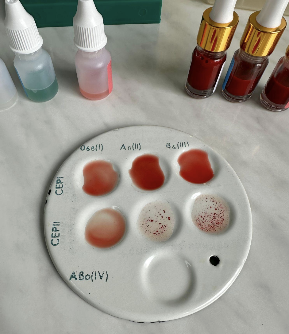 <p>What is blood typing used for?</p>