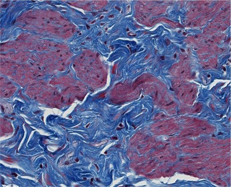 <p><span style="font-family: "Calibri Light";">1. ID the type of muscle. <br><br>2. ID the type of CT proper that surrounds this muscle.</span></p>