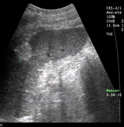 <p>Identify this image. </p>