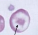 <p>what is it (Abnormalities)</p>