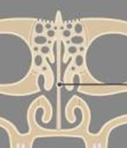 <p>What is this pointing to? What bone is it on?</p>