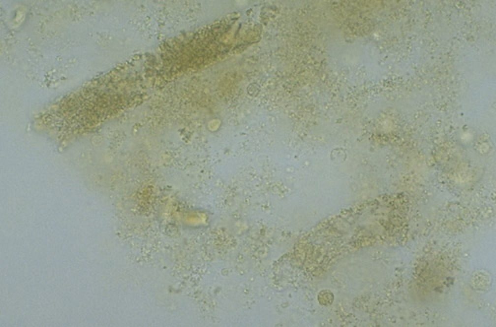 <ul><li><p><strong>The most common type of cast seen in animals.</strong></p></li><li><p>A few can be seen in normal urine sediment.</p></li><li><p>An increased number seen can indicate <strong>acute nephritis,</strong> more sever kidney damage than the hyaline cast.</p></li></ul><p></p>