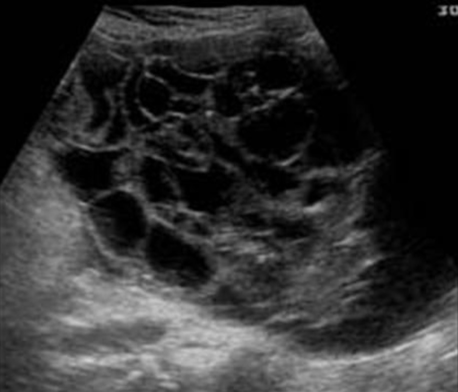 <p>What pathology could this be?</p>