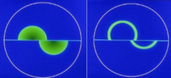 <p>Left: Too much fluorescein</p><p>Right: Probe too low and you need to move joystick up to make semicircles equal in size</p>