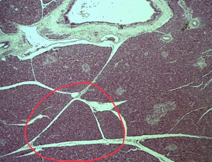 <p>Grouping of tissue within an organ, typically separated by septa</p>