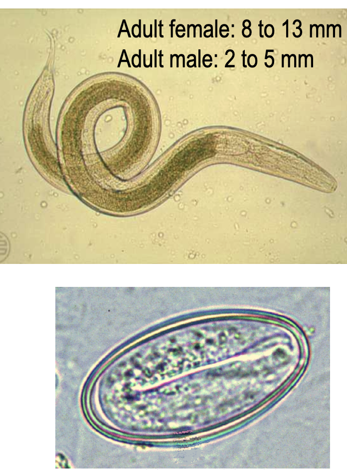 <p>enterobius vermicularis</p>