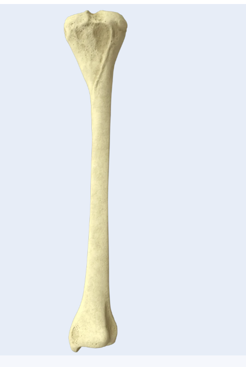 <p>Left or right tibia</p>