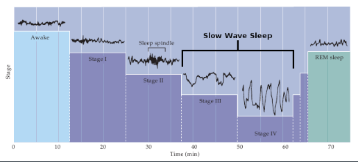 <p><strong><u>Sleep spindles</u></strong><span> and </span><strong><u>K&nbsp;complexes</u></strong><span> appear during stage(s) </span><span style="color: mediumseagreen !important;"><strong>two</strong></span><span> of sleep</span></p>