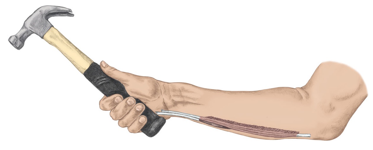 <p><span>extensor carpi ulnaris</span></p><p><span>flexor carpiulnaris</span></p>