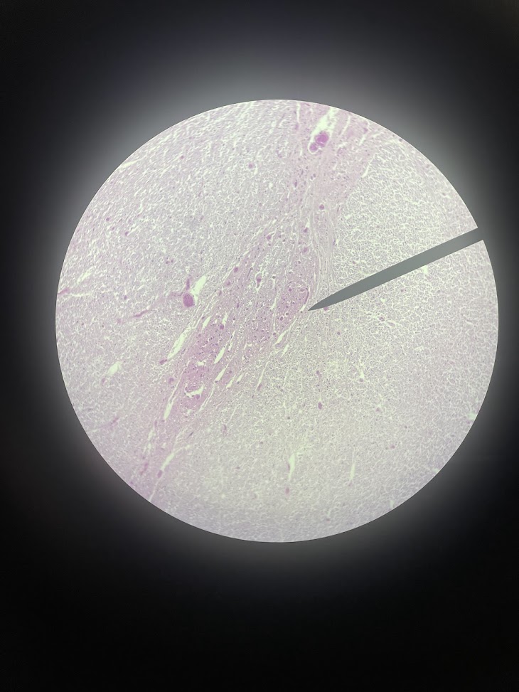 <p>tissue type above and below the pointer (spinal cord)</p>