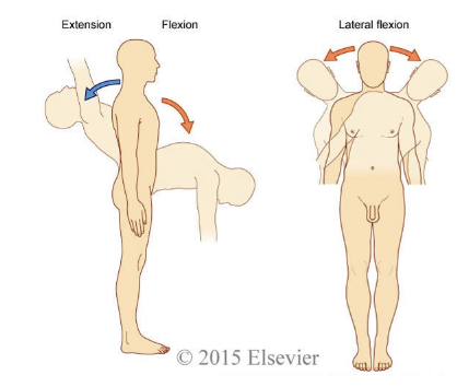 <p>flexion</p>