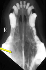 <p>Is this normal or abnormal?</p>