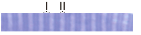 <p>A24) Below is a tissue preparation of skeletal muscle stained with toluidine blue. </p><p>Which of the two marked structures (I or II) will become shorter during contraction?</p>