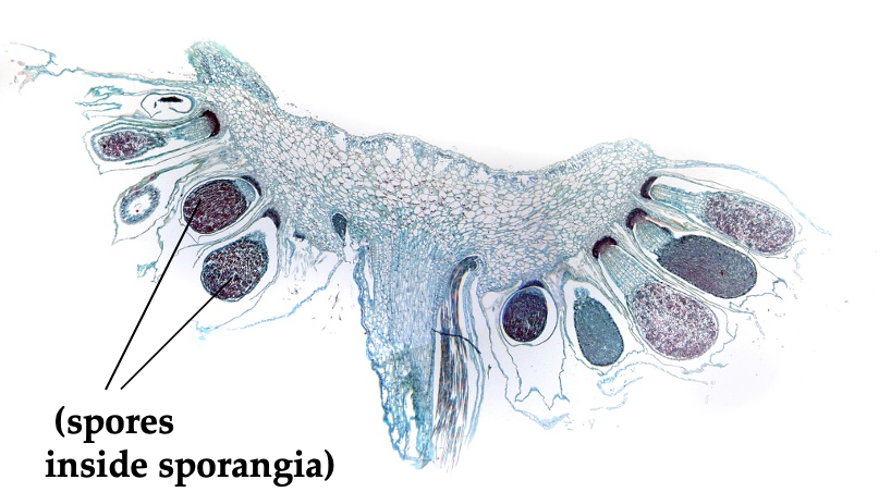 <p>A type of liverwort. The macroscopic view looks like a bunch of boogers with brown noodles. The spores are haploid and the sporophyte is diploid.</p>