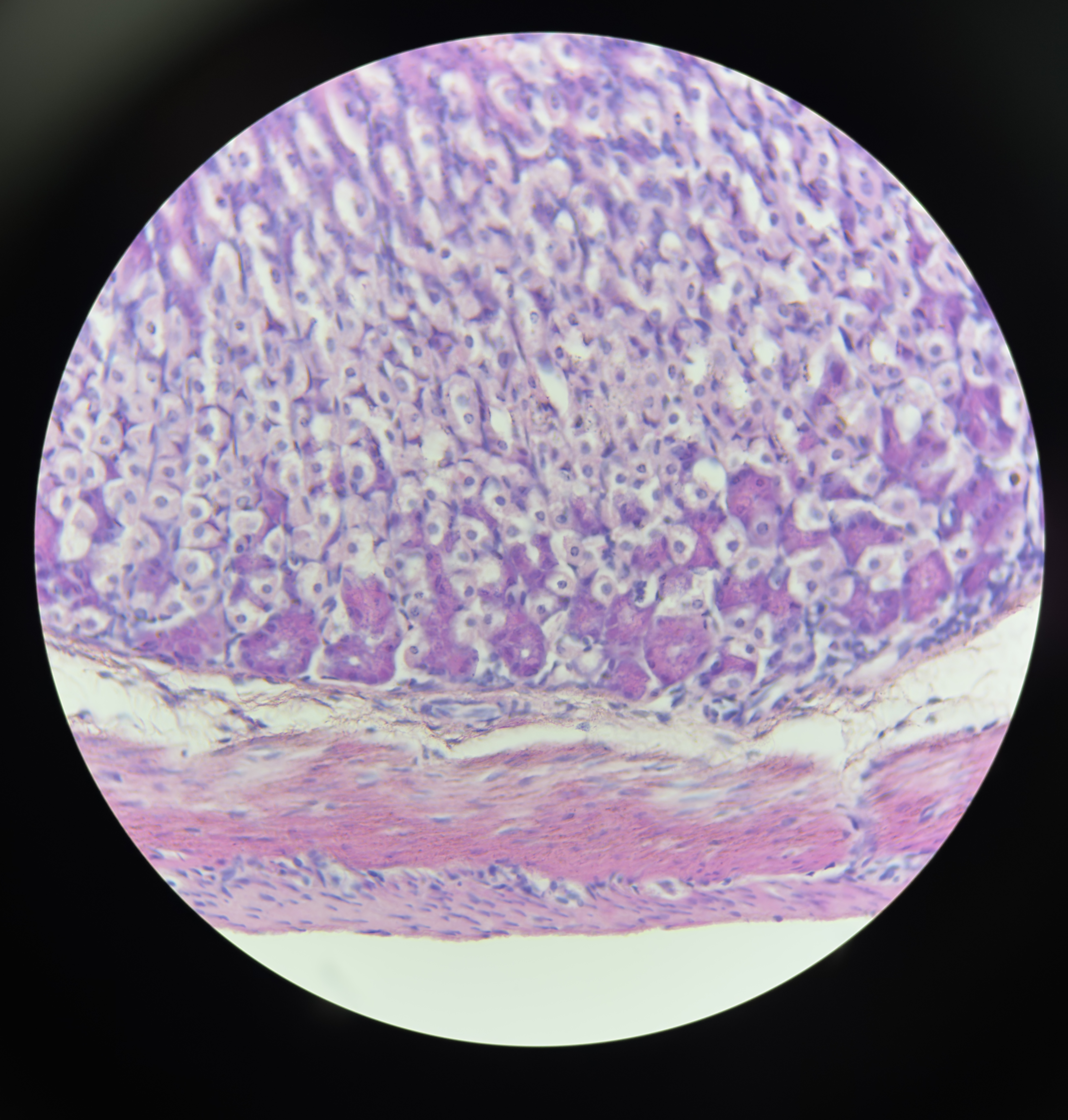 <p>Fundus and body (slika je ista samo izbliza nmo sta mogu da daju)</p>