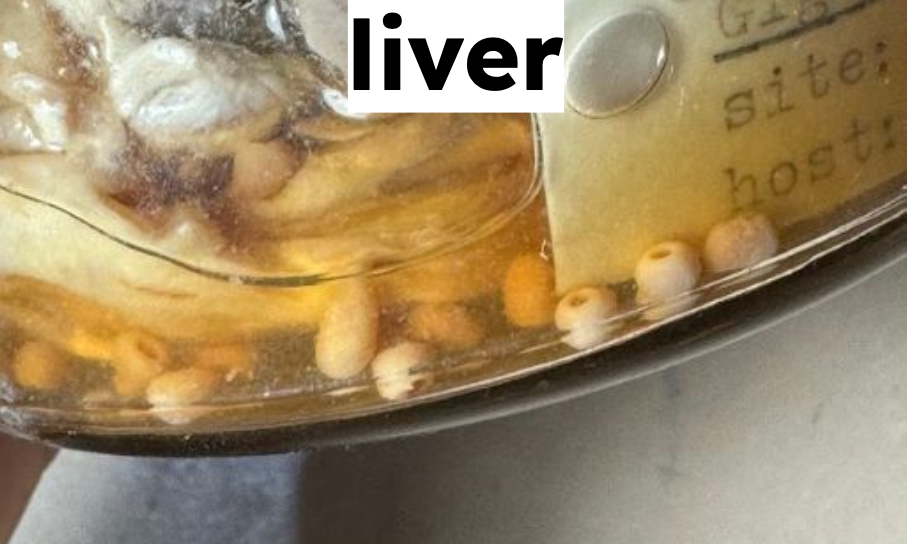 <p>Identification:</p><p>Common name:</p><p>Organ loc: <strong>Abomasum and Rumen</strong></p><p>Intermediate Host:</p><p>Definitive Host:</p><p>Family:</p>