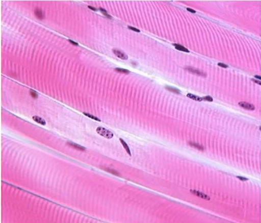 <p>under voluntary control, striated, single long cylindrical cells, multiple peripheral nuclei</p>