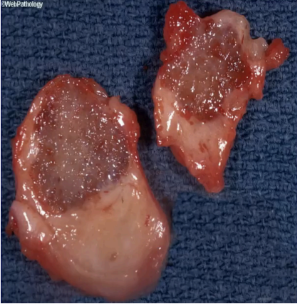<p>What pathology?</p>