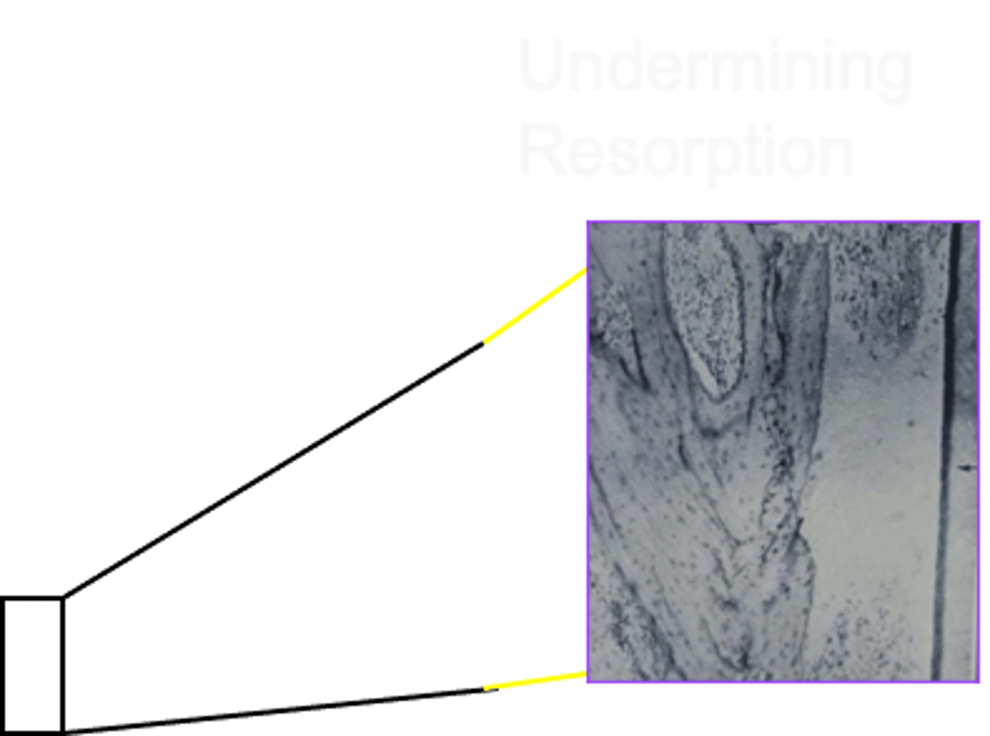 <p>ID the type of resorption:</p>