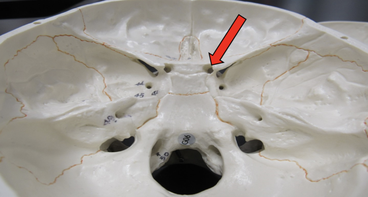 <p><span><strong>Identify the bone marking indicated by the pointer.</strong></span></p>