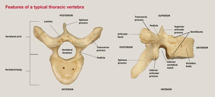 <ol><li><p>vertebral body: the anterior weight-bearing part; attaches at the intervertebral joint to the vertebra above and below it</p></li><li><p>vertebral arch: comprised of pedicles and laminae; forms the posterior boundary of the vertebral foramen</p></li><li><p>pedicle: short, thick projection protuding posteriorly from each side of the body</p></li><li><p>lamina: flat plates continuing from pedicles; attach to each other posteriorly in the midline</p></li><li><p>transverse processes: prject laterally from where each pedicle meets its lamina; for muscle and ligament attachments</p></li><li><p>spinous process: projects posteriorly from the midline junction of the laminae; for muscle and ligament attachments</p></li><li><p>vertebral foramen: the central opening within the vertebral arch; when vertebrae are joined, forms the vertebral canal</p></li><li><p>superior articular processes: project upward to articulate with the vertebra above at the zygapophyseal joints</p></li><li><p>inferior articular processes: project downward to articulate with the vertebra below the zygapophyseal joints</p></li><li><p>inferior vertebral notch: indentation on inferior surface of pedicle; when vertebrae join, forms the intervertebral foramina where nerves exit</p></li></ol><p></p>