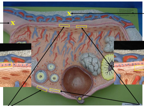 <p>Identify the left X, the pink structure. </p>
