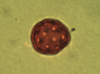<p>Identify the pollen grains to the <strong>Family </strong>level</p>