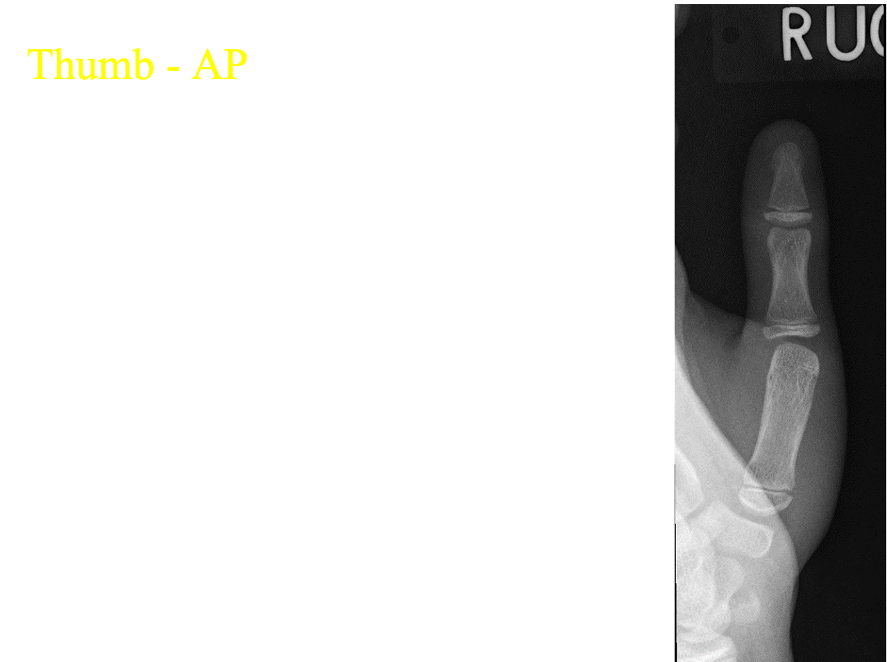 <p>Which x-ray projection + structure is shown?</p>