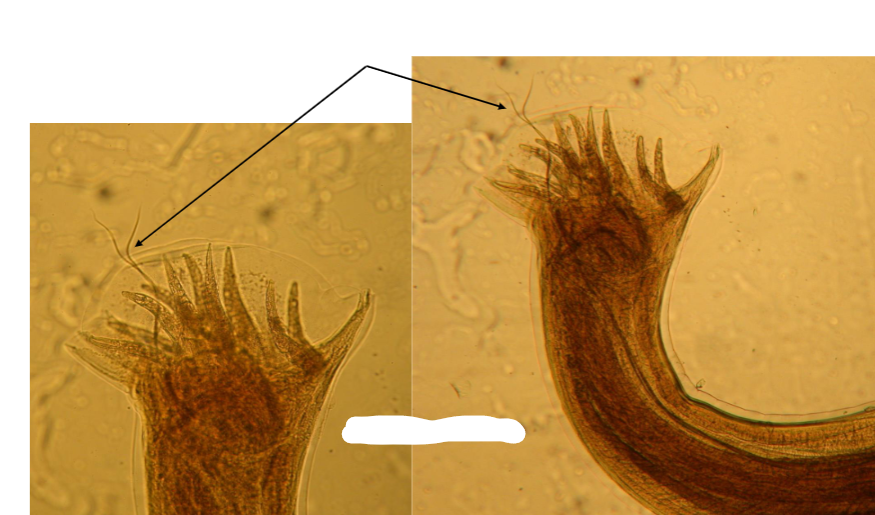 <p>What is this parasite, and what are the structures</p>