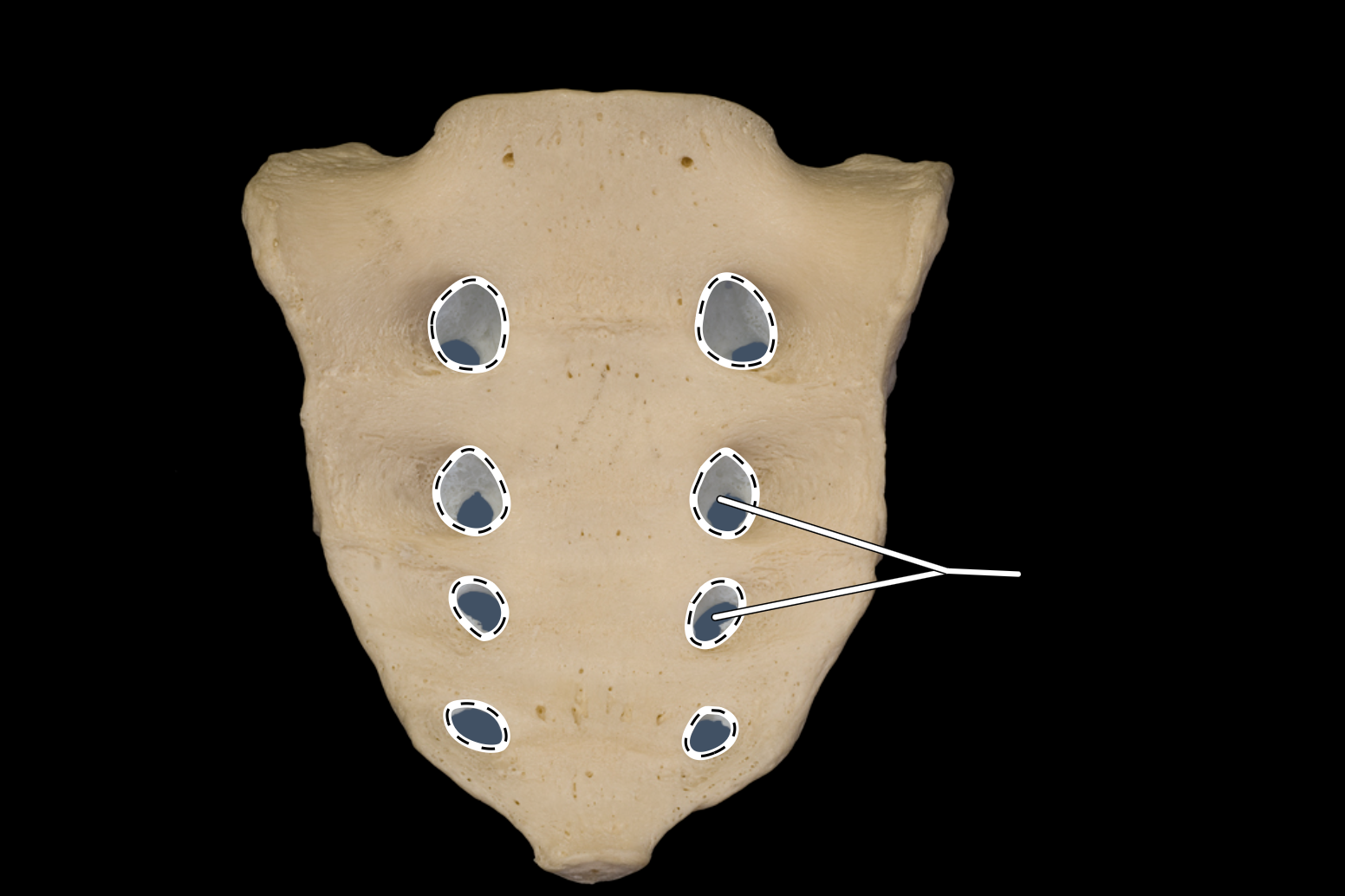 <p>anterior view</p>
