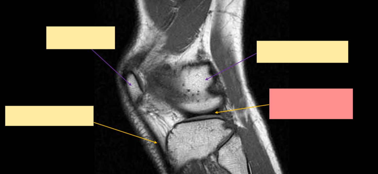 <p>Identify the structure</p>