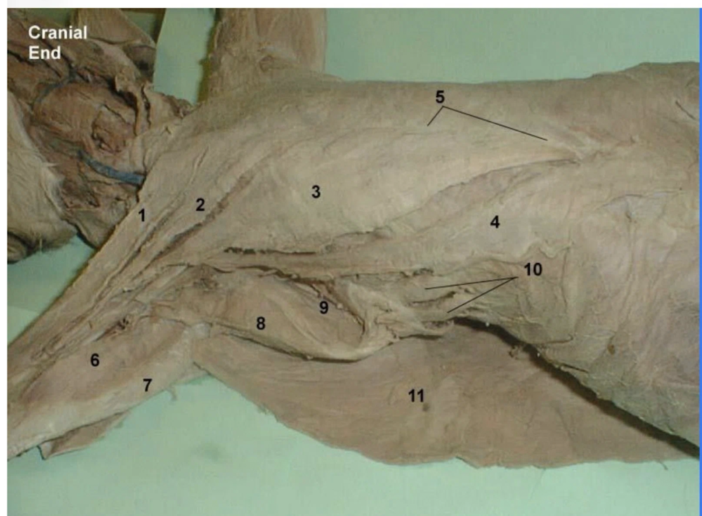 <p>What is 1? This is a part of the thoracic muscles</p>