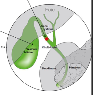 <ul><li><p><strong>A</strong> : Canal cystique</p></li><li><p><strong>B</strong> : Cholédoque</p></li><li><p><strong>C</strong> : Vésicule biliaire</p></li><li><p><strong>D</strong> : Duodénum</p></li><li><p><strong>E</strong> : Pancréas</p></li></ul><p></p>