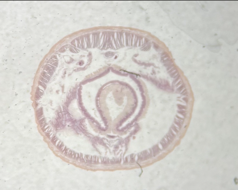 <p>What phylum, class, and subclass does this belong to? </p>