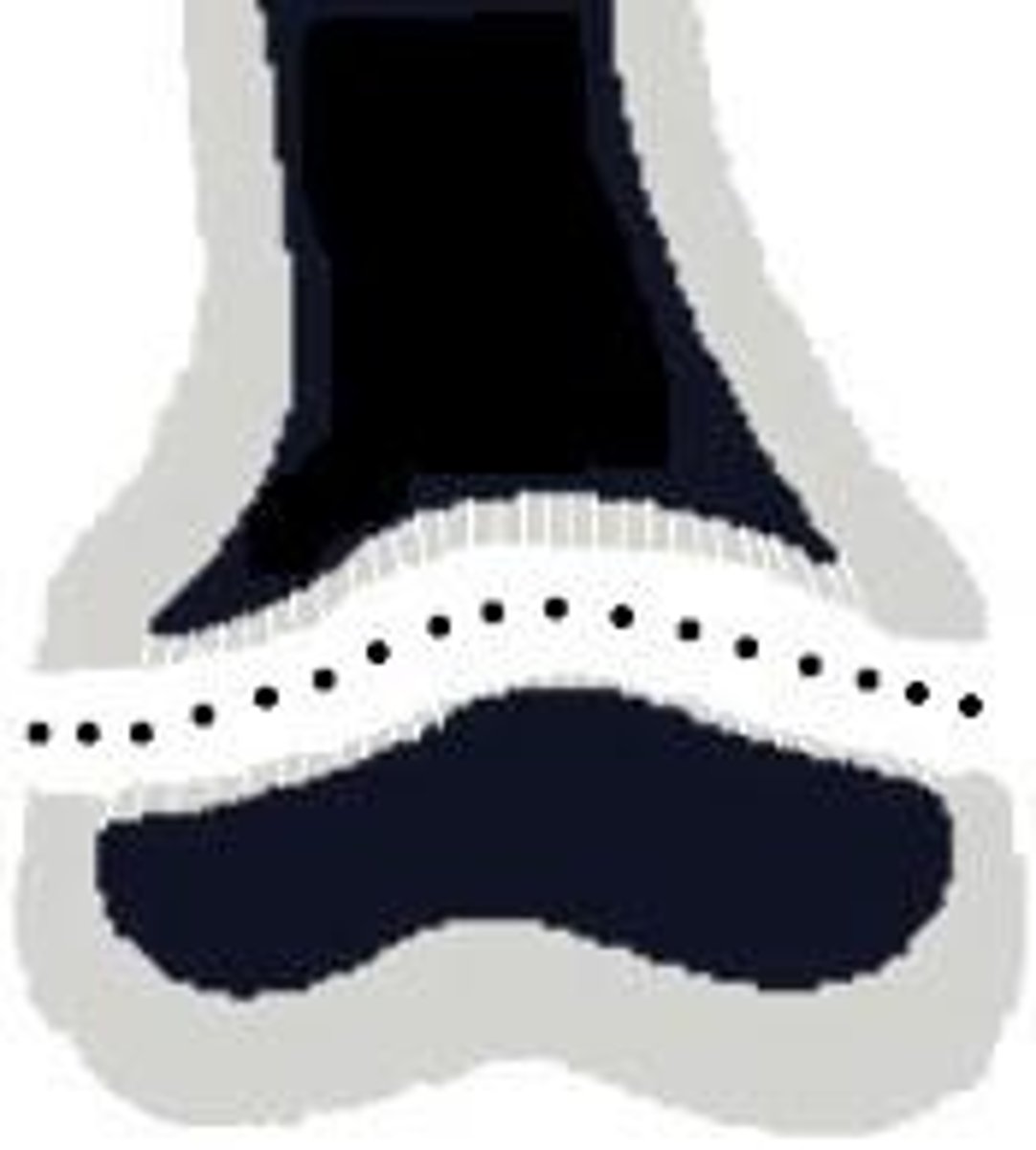 <p>fracture across the growth plate (AKA separation of physis) (S – Slipped);</p>
