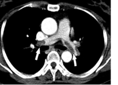 <p>identify the pathology:</p>