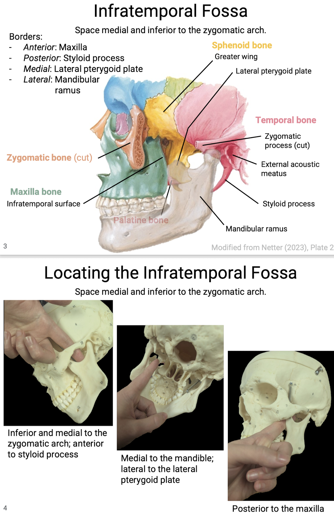 <p>Space medial and inferior to the zygomatic arch.</p><p>Borders: Infratemporal surface of maxilla (anterior), styloid process (posterior), lateral pterygoid plate (medial), mandibular ramus (lateral).</p>
