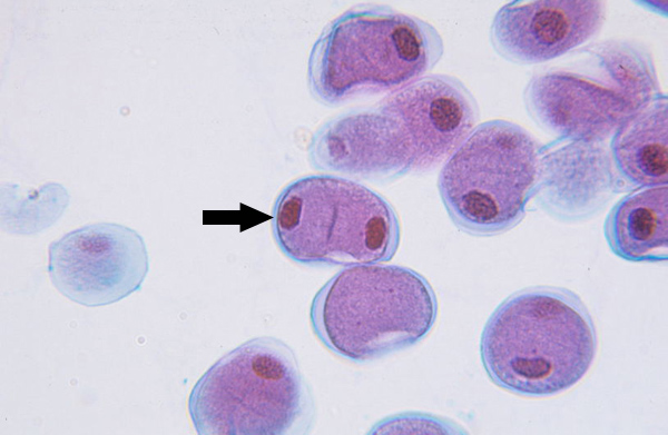 <p>Nuclear envelopes reform around the two sets of chromosomes, and the spindle disappears</p>