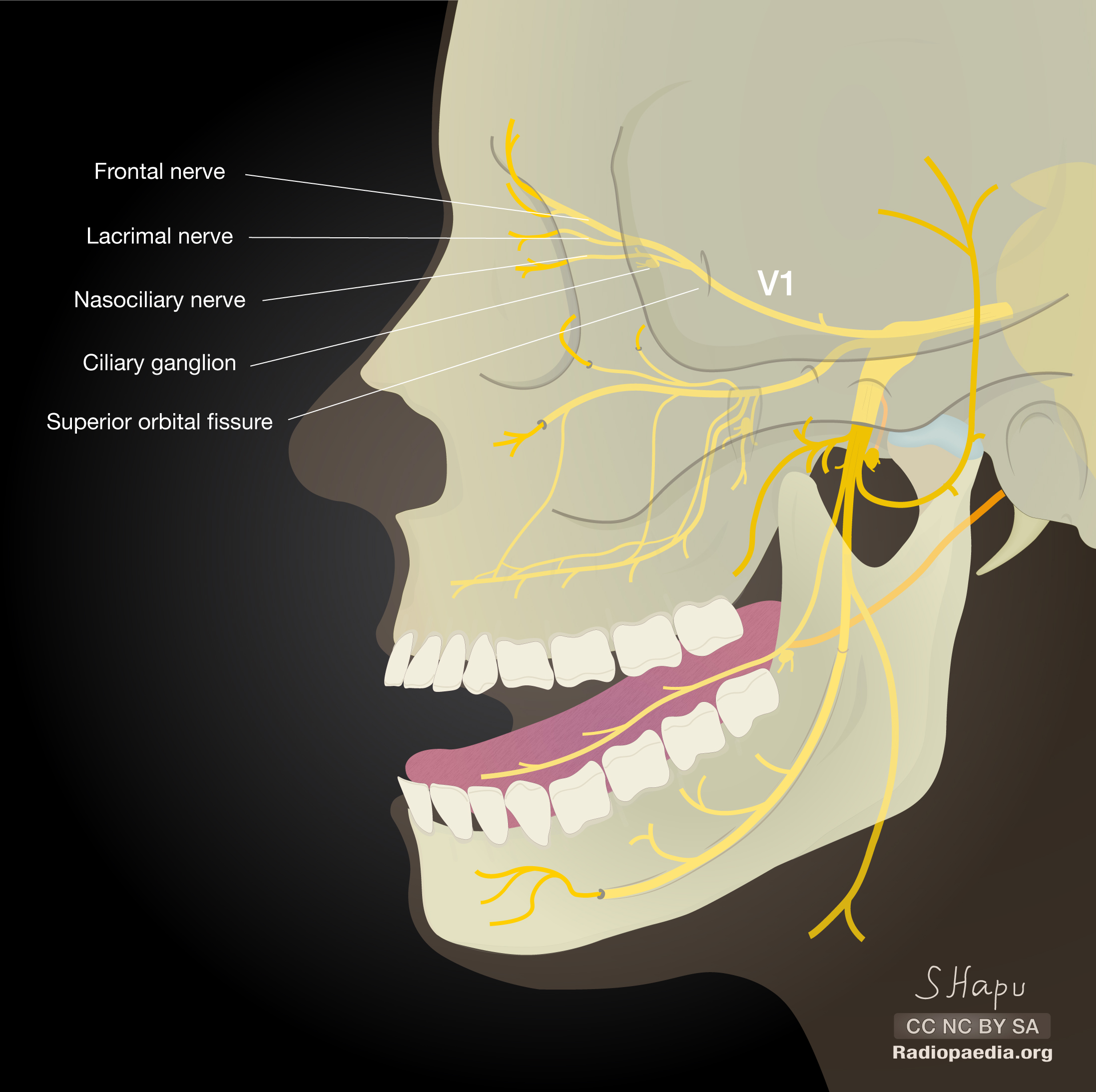 <ol><li><p><strong>Nervus frontalis</strong> (felső szemhéjemelő izom fölött halad az orbita bemenetéig) — <strong>n. supratrochlearis és n. supraorbitalis </strong>= homlok és falcsont feletti <strong>bőr idegei</strong></p></li><li><p><strong>N. nasociliaris </strong>(az a. ophtalmicat kíséri)</p></li><li><p><strong>N. lacrimalis</strong> (külső egyenes szemizom felső szélén halad) = <strong>kötőhártya, szemhéj és könnymirigy</strong></p></li><li><p>R. communicans cum nervo zygomatico = <strong>könnymirigy</strong></p></li></ol><p></p>
