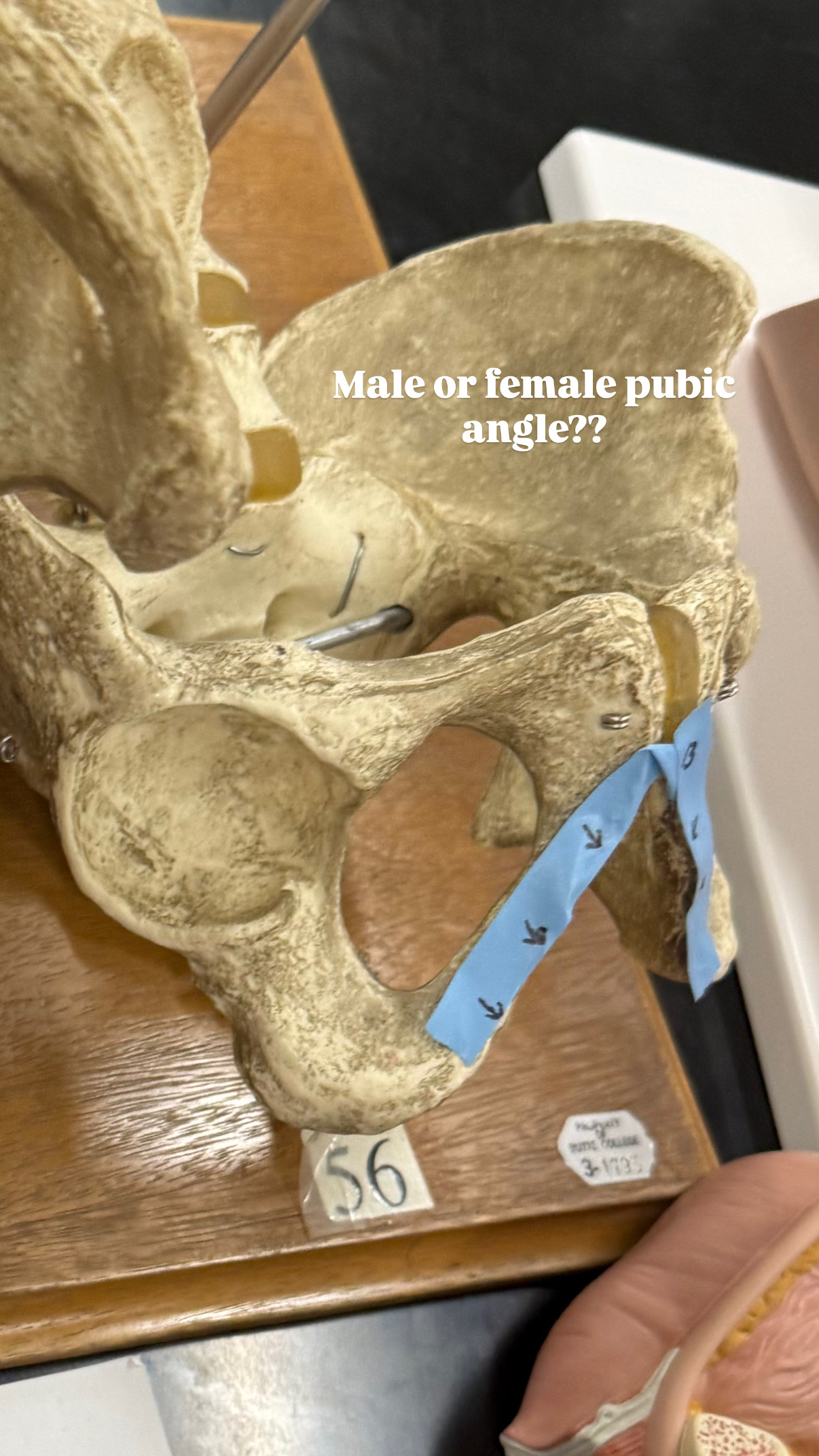 <p>look at the angle, decide if it is male or female</p>