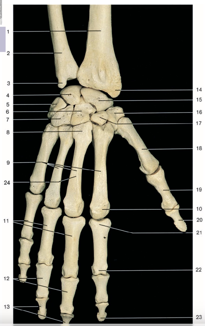 <p>Pinche 17</p>