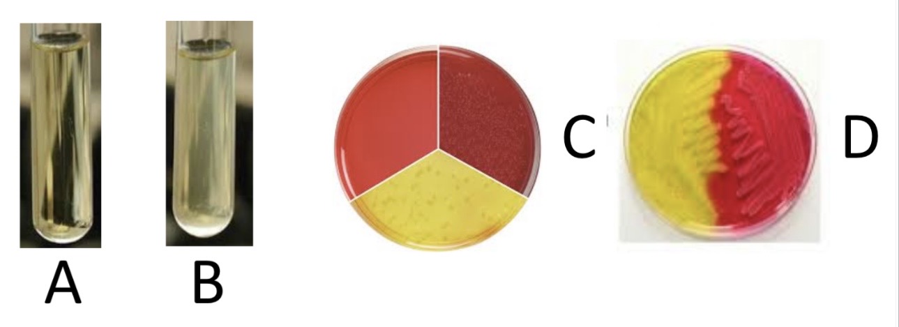 <p>Mannitol Salt Plate/Gram Positive Cocci Experimentation Day # 2</p><p>a) Medium?</p><p>b) Substrate?</p><p>c) Enzyme?</p><p>d) Indicator/Reagent?</p><p>e) End Product?</p>