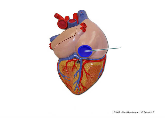 <p><span>The highlighted vessel returns blood from the body to which chamber of the heart?</span></p>
