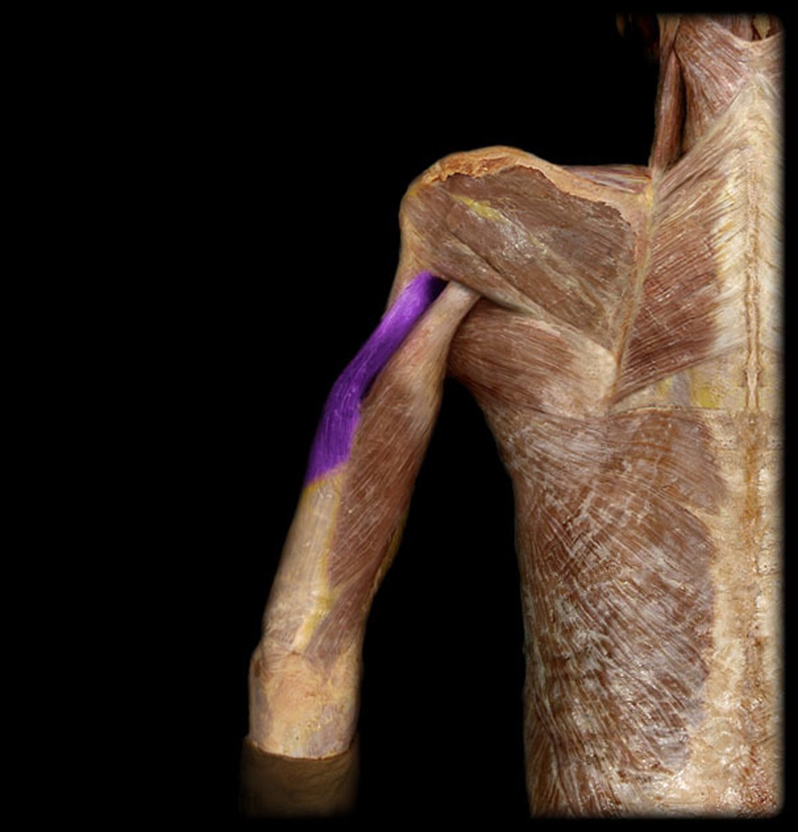 <p>Origin: posterior humerus (proximal)</p><p>Insertion: posterior part olecranon of ulna and deep fascia of the forearm</p>